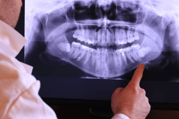 Best Broken or Chipped Tooth Repair in Water Mill, NY